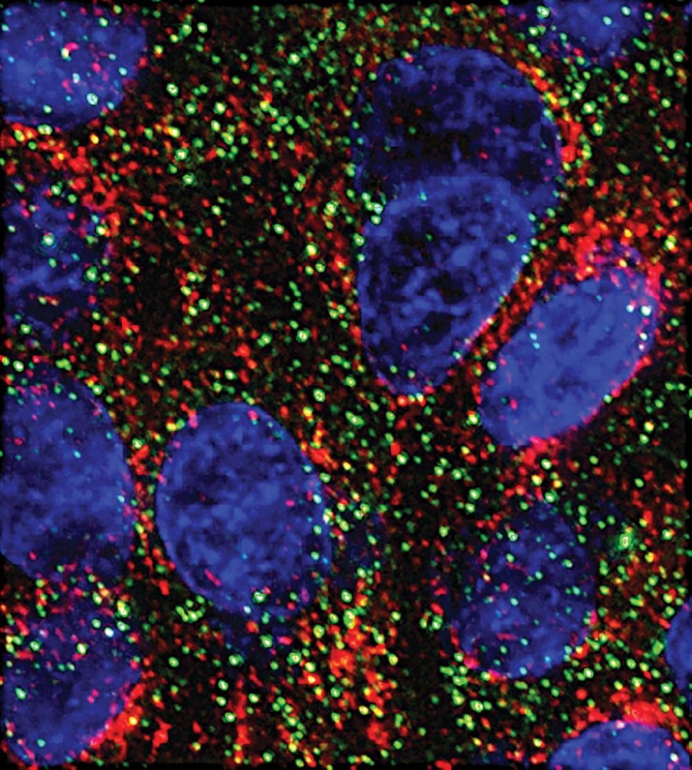 Dos microARN frenan el crecimiento de células pancreáticas en laboratorio